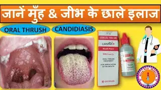 Candid mouth paint