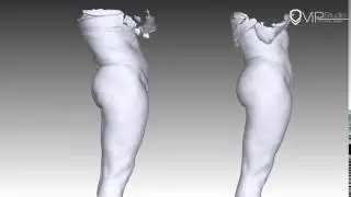 3D Липофиллинг ягодиц. (Увеличение ягодиц). Хирург Гурьянов А.С.