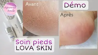 Comment faire un soin des pieds LOVA SKIN | Démo instant foot peeling