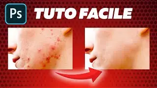 NE PLUS AVOIR DE BOUTONS ET LISSER SA PEAU GRÂCE À PHOTOSHOP