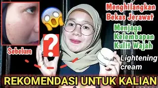 NATURAL & LIGHTENING CREAM || Menghilangkan Bekas Jerawat