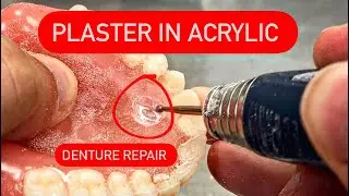 FIXING DENTURES (processing error) #waxbae #dentures