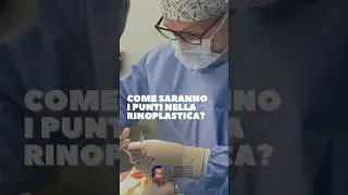 Come saranno i punti nella 