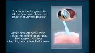 Oral Hygiene - Miskin Ajax Dental
