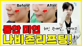 어려짐은 필수! 예뻐짐은 덤! 나비존리프팅 시술 전과정을 보여드려요(전후사진有)