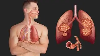 About massage for respiratory diseases. Goals, objectives, methods, techniques, massage technology
