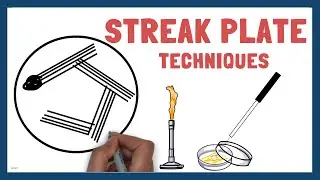 Streak Plate methods and techniques in Microbiology