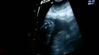 100_3439.MOV