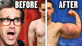 Reacting To Extreme Before And After Photos