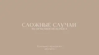 Фильм «Сложные случаи. Из практики подолога»  #подология #подолог #подологмосква #лечениеногтей