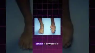 Рекорд Гиннесса - Гарри Тёрнер Резиновая Кожа😬