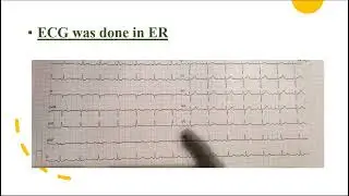 echo conference , aortic dissection 24-1-2024