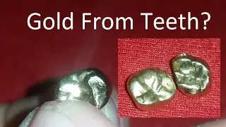 Precious Metal Refining & Recovery, Episode 17: Teeth