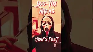 BooTox Treatment Areas #youtubeshorts