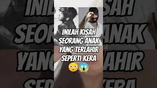 inilah kisah seorang anak yang terlahir seperti kera #shorts