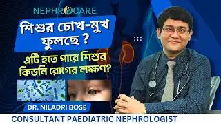 শিশুর চোখ-মুখ ফুলছে? এটি কি শিশুর কিডনি রোগের লক্ষণ? Child’s eyes and face swelling | Dr. Niladri