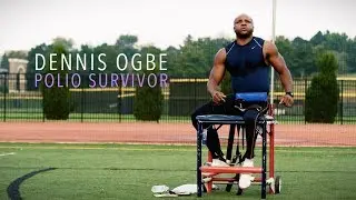 Polio Survivor Dennis Ogbe