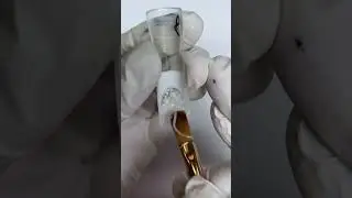 Причины трещин в точках вроста при наращивании на верхние формы.