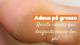 Desgruda cascão dos pés e deixa lisinho