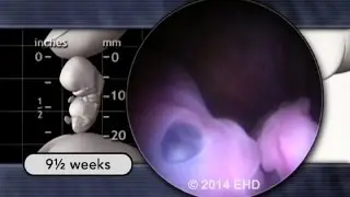 See Baby Pregnancy Guide