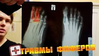 ВСЕ ТРАВМЫ ФИФЕРОВ