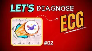 ECG Interpretation | ECG Quiz 02 🩺✨ | LET'S DIAGNOSE ECG - Series.