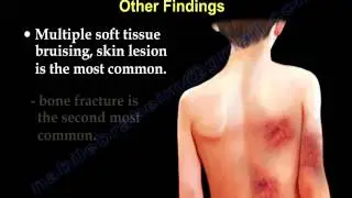 Child Abuse - Everything You Need To Know - Dr. Nabil Ebraheim