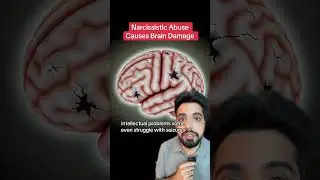 This is what narcissistic abuse can do to your brain #narcisisst