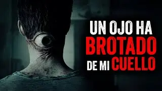 Un OJO ha BROTADO de mi CUELLO / Creepypasta