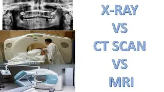 What is a difference between X-RAY , CT-SCAN & MRI.