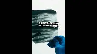 Discovery of X-Rays - MOST Interesting Facts