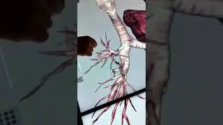 La tráquea