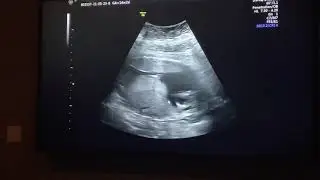 Waylon 5/23 pt1