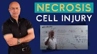 Necrosis Cell Injury | Apoptosis | General Pathology🦠