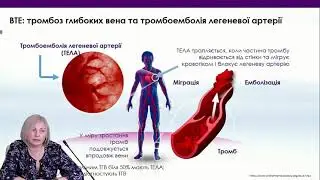 Лікування ТЕЛА: кому і ннаскільки слід продовжувати антикоагулянтну терапію