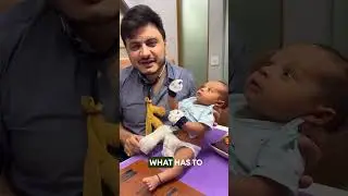 Club foot #drimranpatel #doctor #childspecialist #asianchildrenhospital