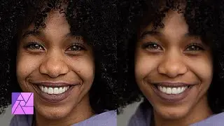 Removendo cravos, espinhas e manchas usando o Affinity Photo