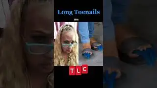Long Toenails (TLC)