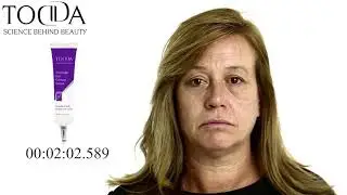 קמטים בפנים? תוך 2 דקות 10 שנים פחות מבית TODDA , הקרם המהפכני שמעלים קמטים וקמטוטים תוך 2 דקות.