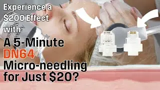 Experience a $200 Effect with a 5-Minute DN64 Micro-needling for Just $20?