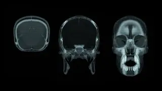 How to create a CT Scan Slice Animation in Blender