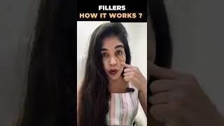 Mastering Beauty: Dr. Anvika Unveils the Science Behind Fillers!