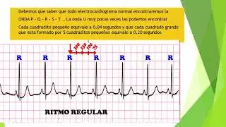 Electrocardiograma interpretacion parte 1