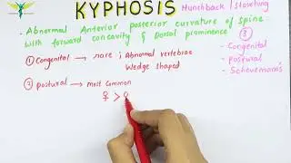 Kyphosis - Medical symptomatology | Types and Causes