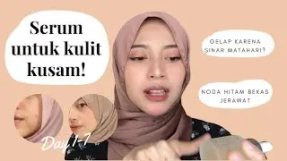 MENGHILANGKAN NODA HITAM BEKAS JERAWAT DALAM 7 HARI! Cobain serum Licorice dan Niacinamide! 20Mefree