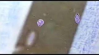 Euglena  movement