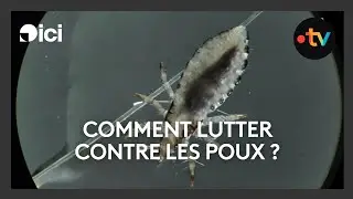 Comment lutter contre les poux ? Un chercheur lillois a conçu un produit à base de résine.