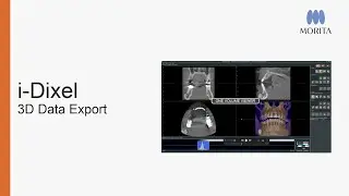 How to export CT data and DICOM series from i-Dixel