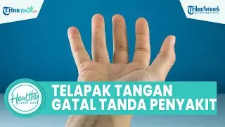 Waspadai Telapak Tangan Gatal Bisa Jadi Tanda Penyakit Serius: Eksim hingga Diabetes Mellitus