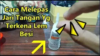 Cara Melepaskan Kulit Jari Yang Terkena Lem Korea / Alteco